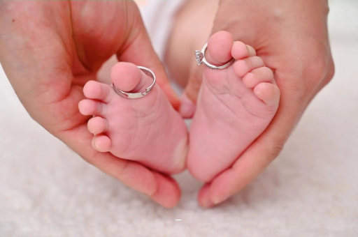 泗阳怀孕妊娠线不明显